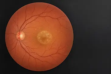 Early Detection