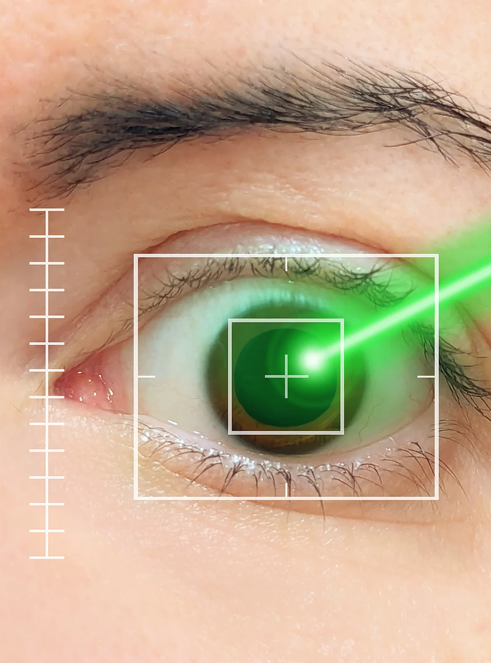 Diabetic Eye Disease