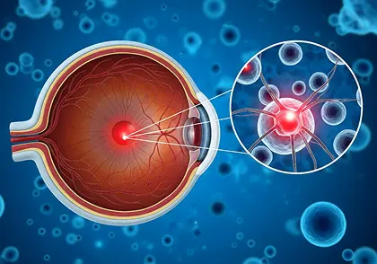 How Is Retinal Vascular Disease Diagnosed
