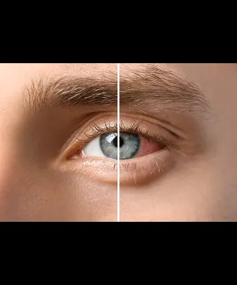 How Is Retinal Vascular Disease Diagnosed
