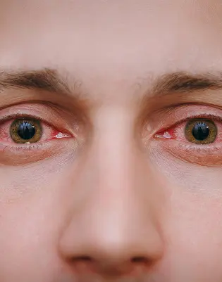 Retina Emergency