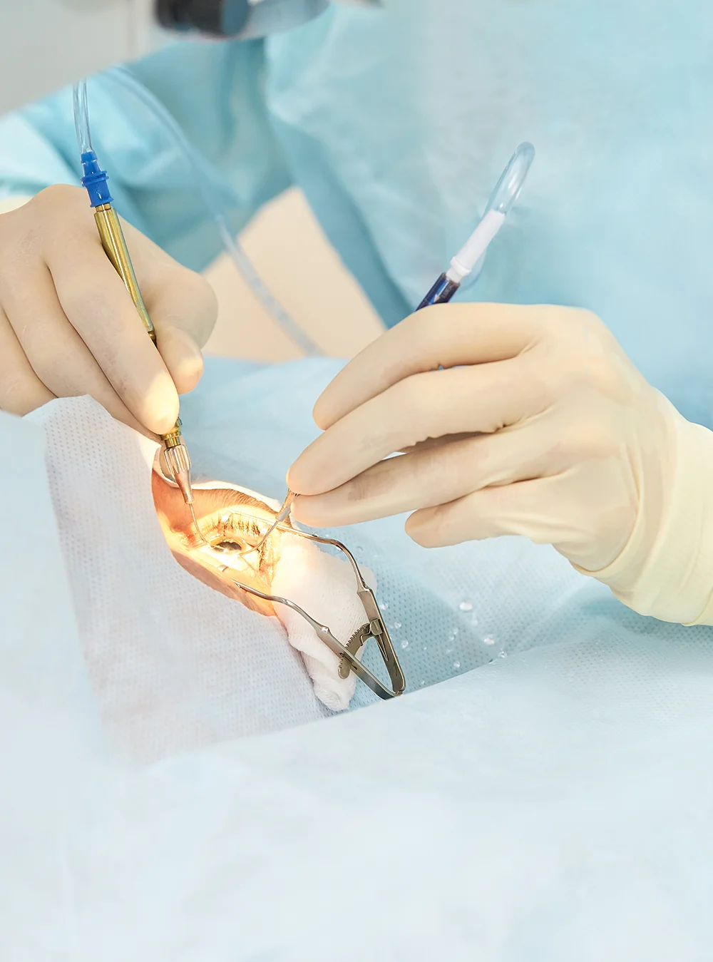 Diabetic Retinopathy