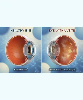 How Is Retinal Vascular Disease Diagnosed