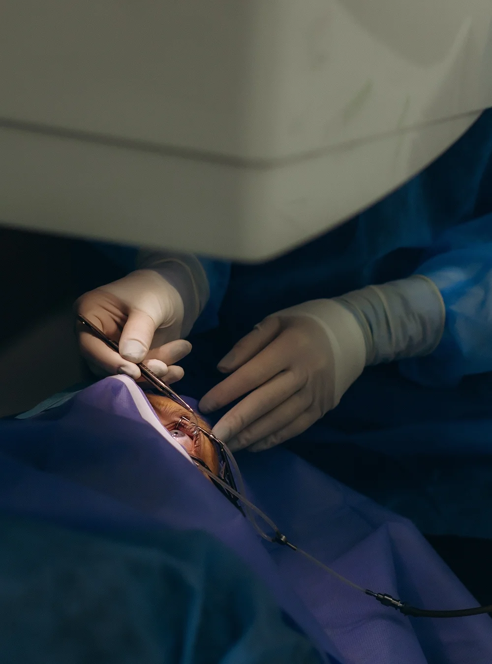 Vitrectomy Eye Surgery
