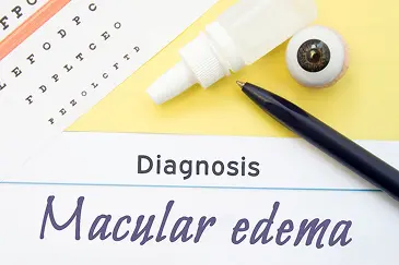 How Is Retinal Vascular Disease Diagnosed