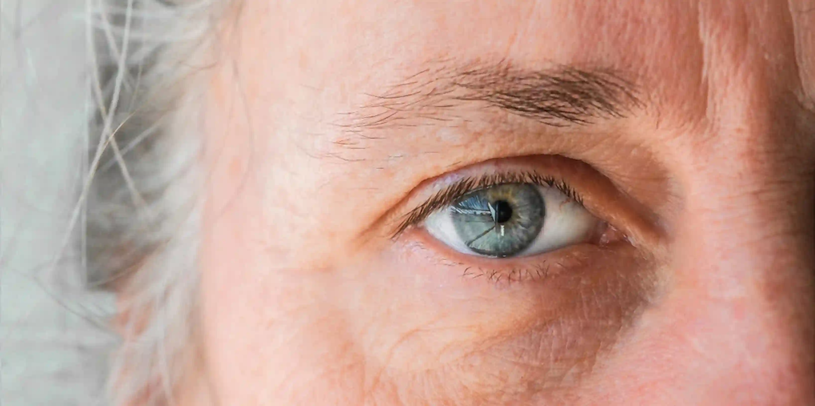 Eye Conditions That Cause Blindness
