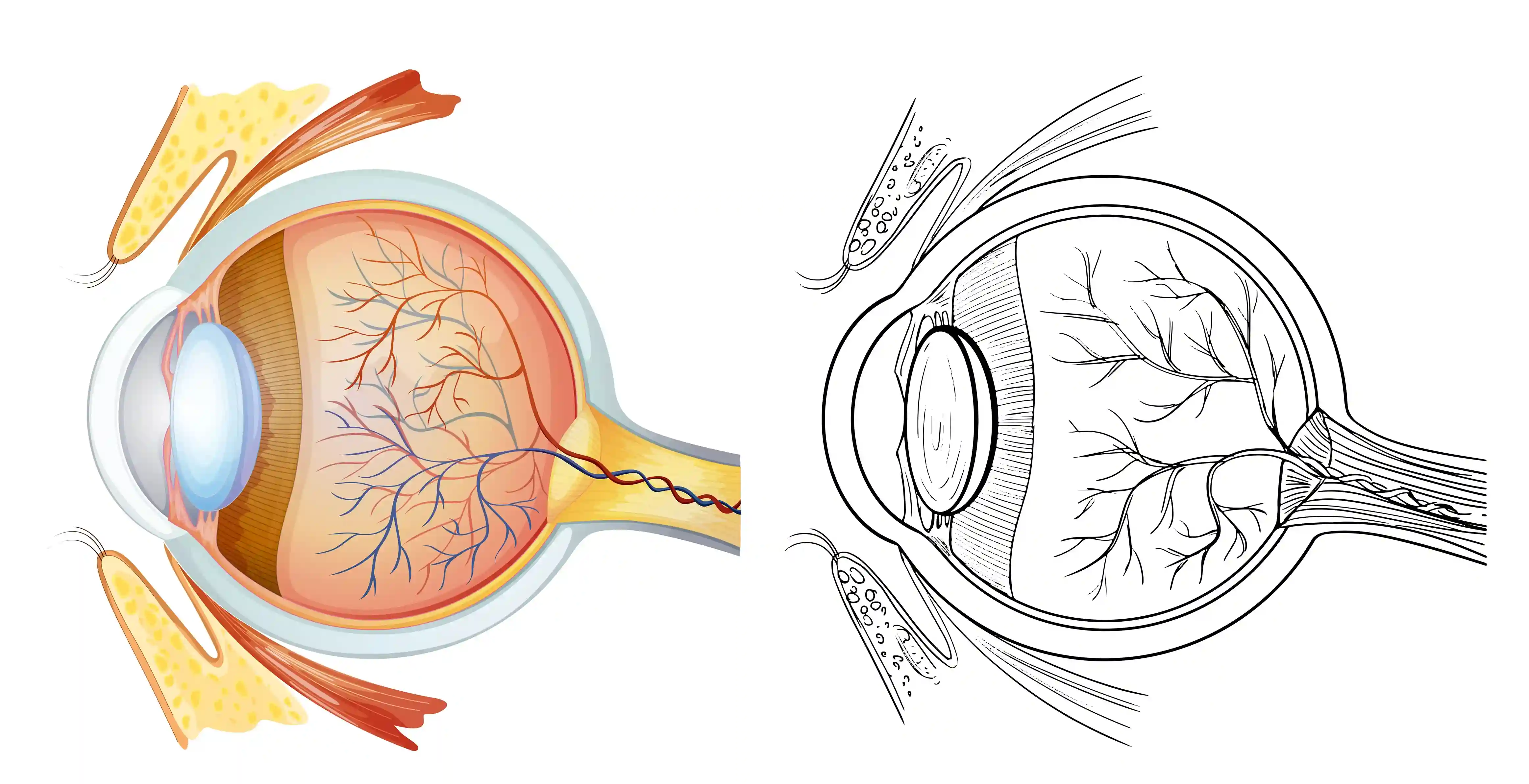 Epiretinal Membrane Retina