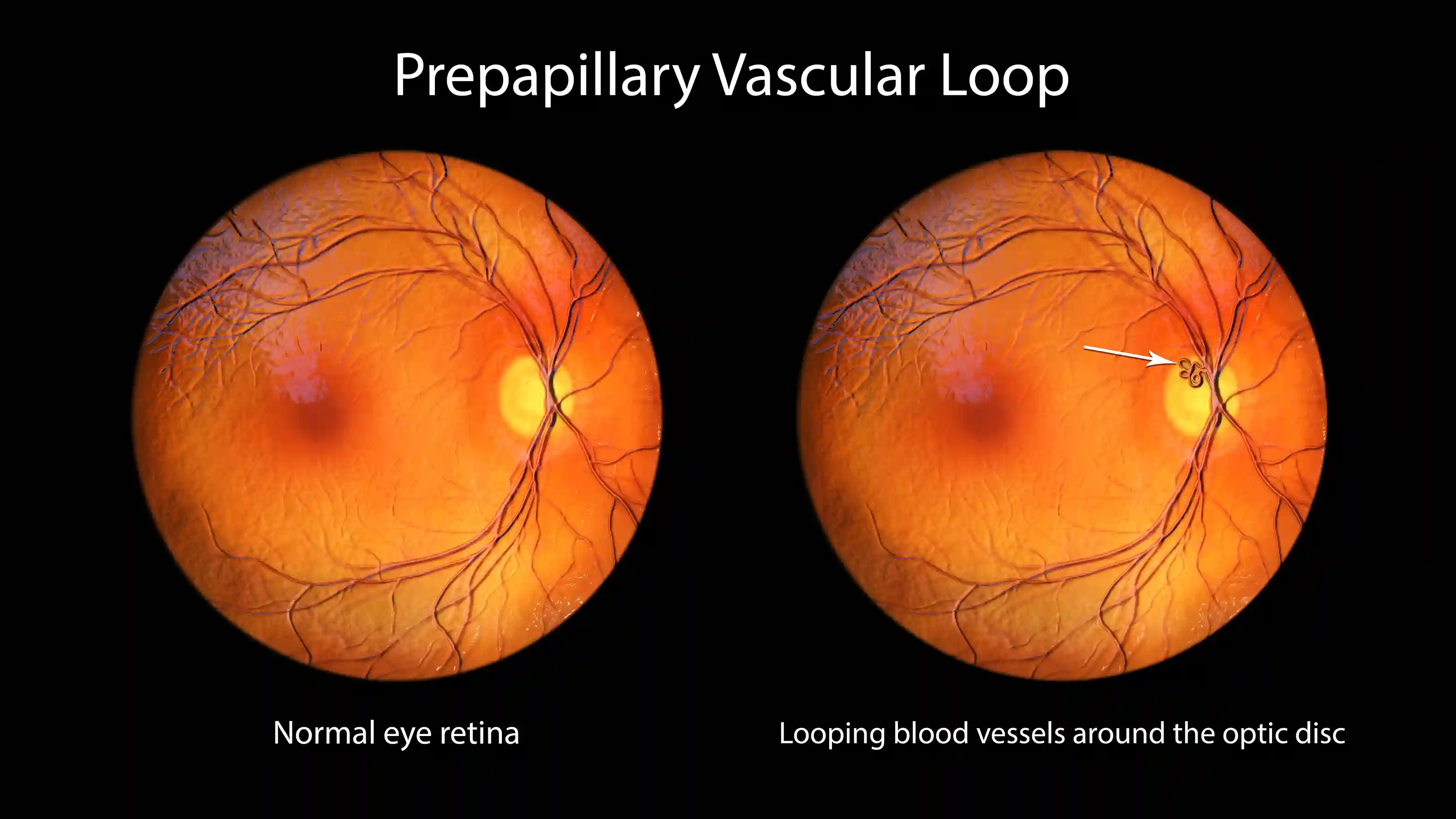 Retinal Blood Supply